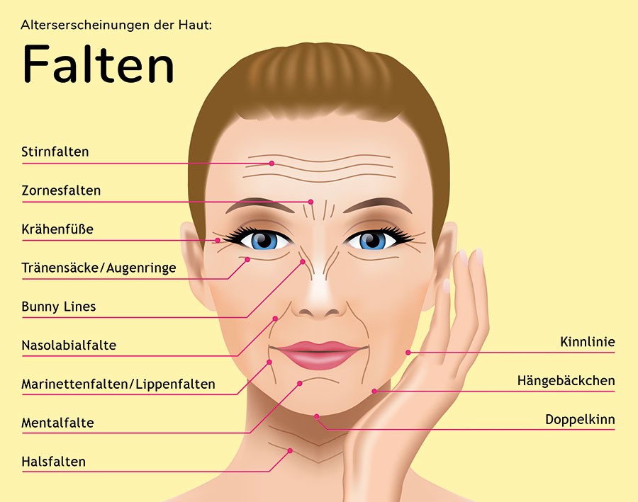 Falten sind die häufigste Altererscheinung im Gesicht. Viele lassen sich gut behandeln.