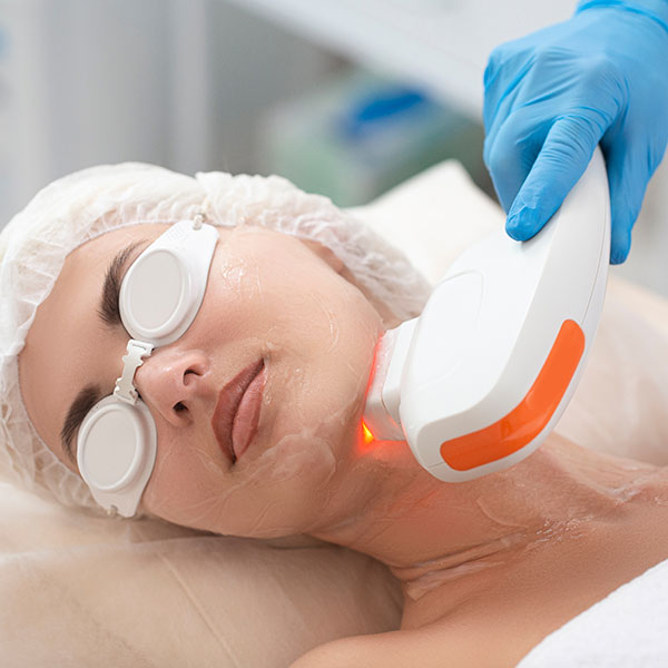 Das Hautbild kann der Hautarzt durch eine Hautverjüngung mit dem Laser verbessern